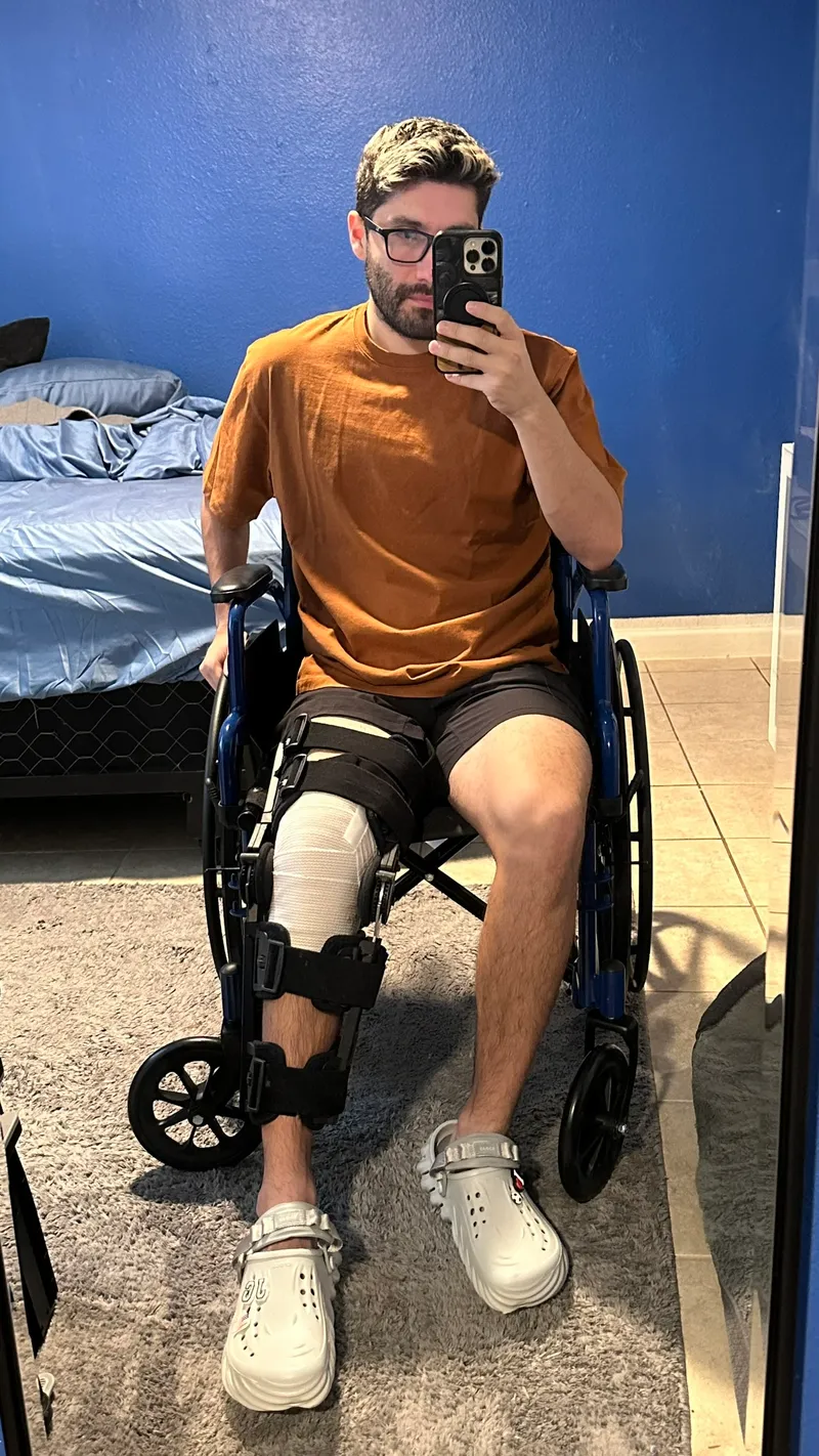 the knee